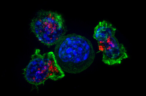 NIH T Cells
